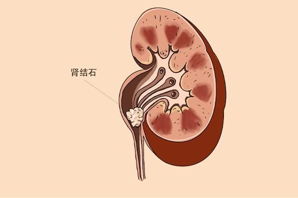 50岁以后如果不差钱3种茶能不喝就不喝早知早受益开云 开云体育APP(图4) 50岁以后如果不差钱3种茶能不喝就不喝早知早受益开云 开云体育APP(图4)